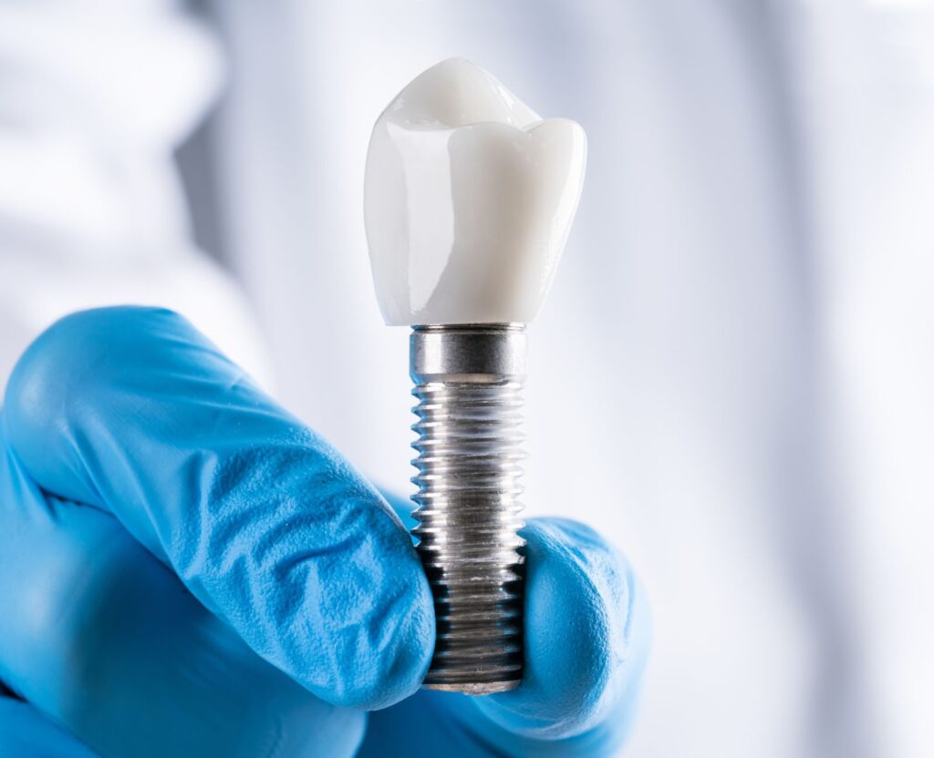 Wstawianie implantów zębowych w Medin Klinice w Opolu