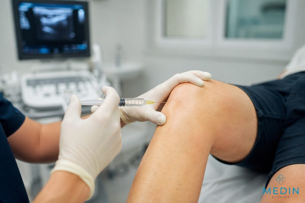 iniekcje kwasem hialuronowym w kolano