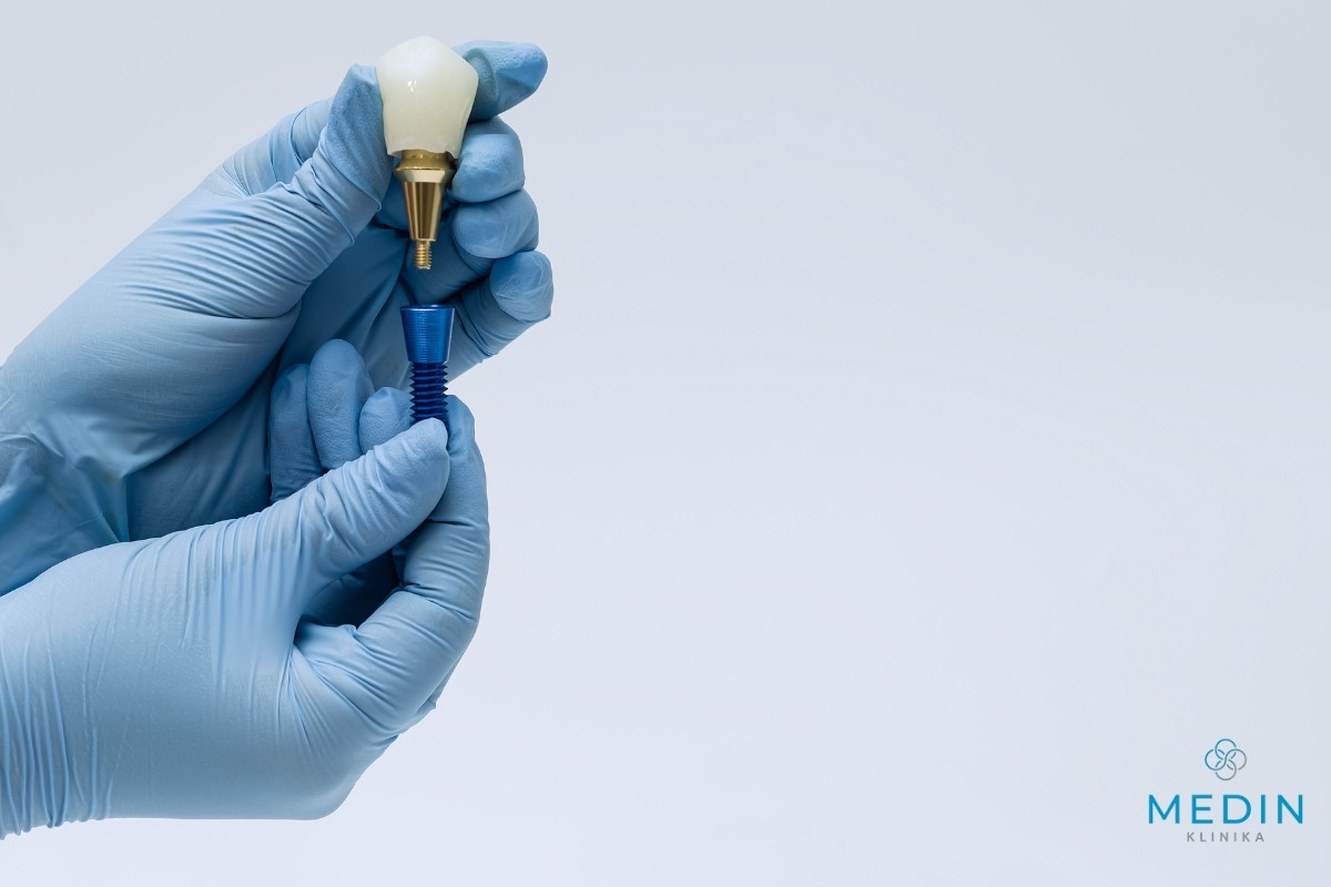 przeciwwskazania do implantów zębowych